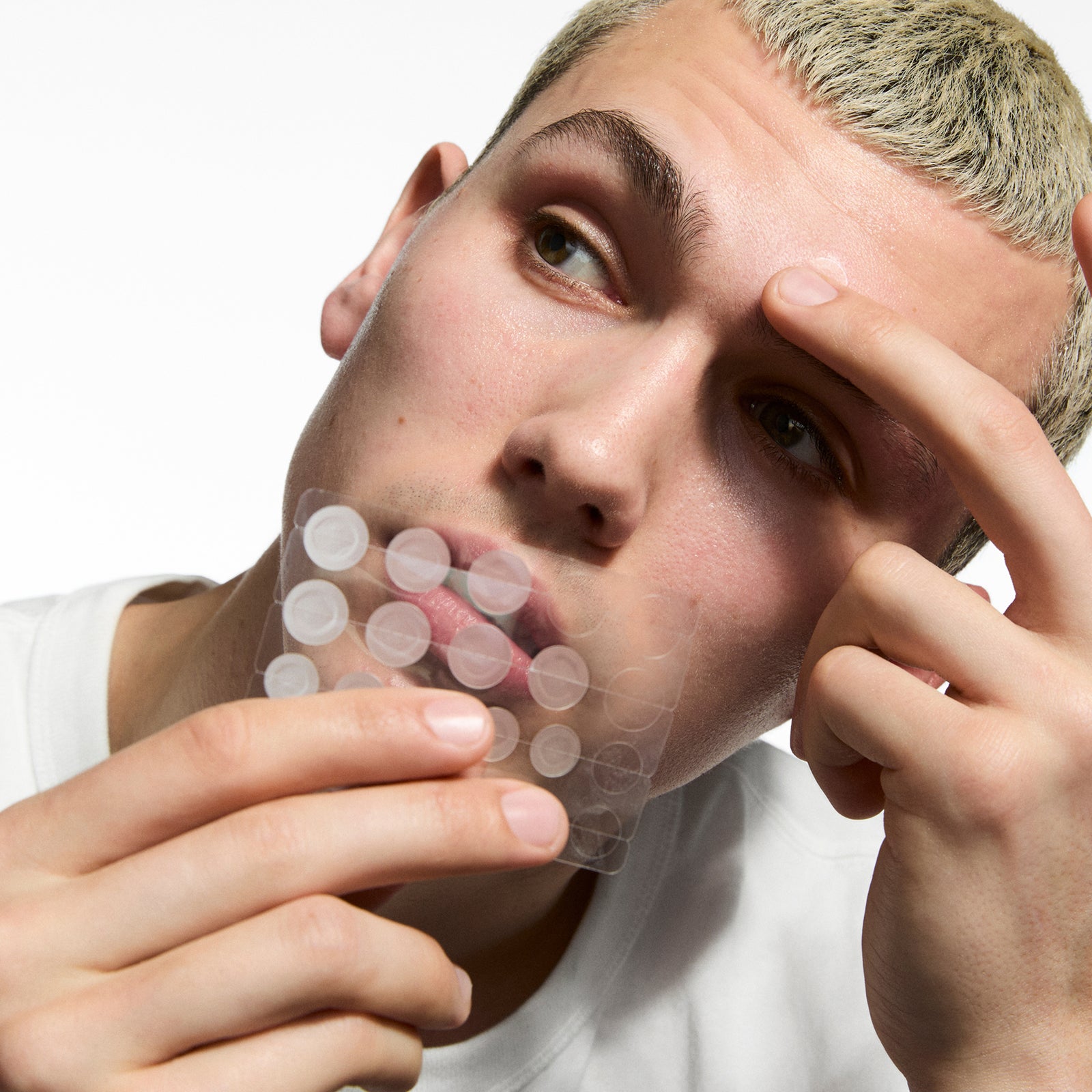 AI-Powered Acne Patches vs Traditional Treatments: Which Works Better in 2026?