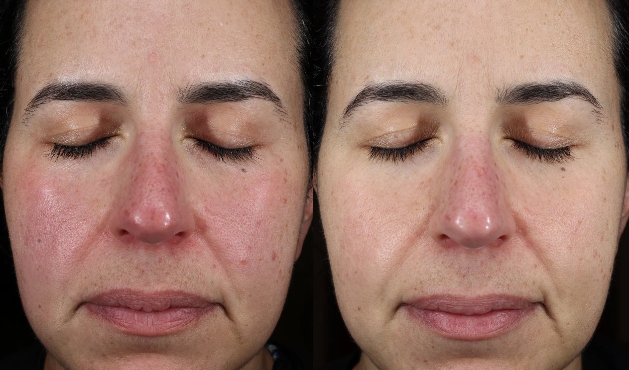 Skin Science