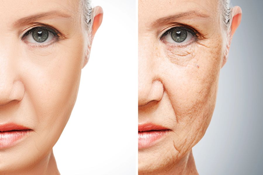 Acne Causes and Lifestyle Factors