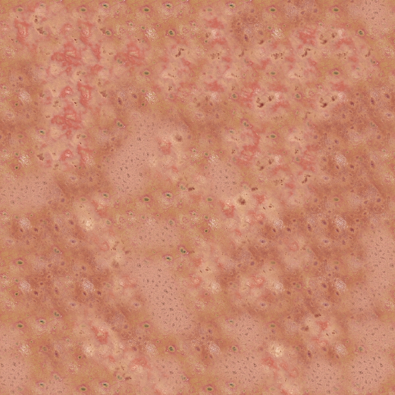 Acne resource