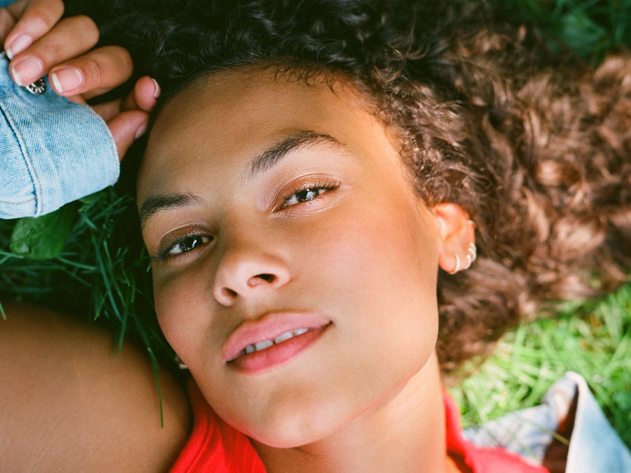 post-laser treatment sun sensitivity