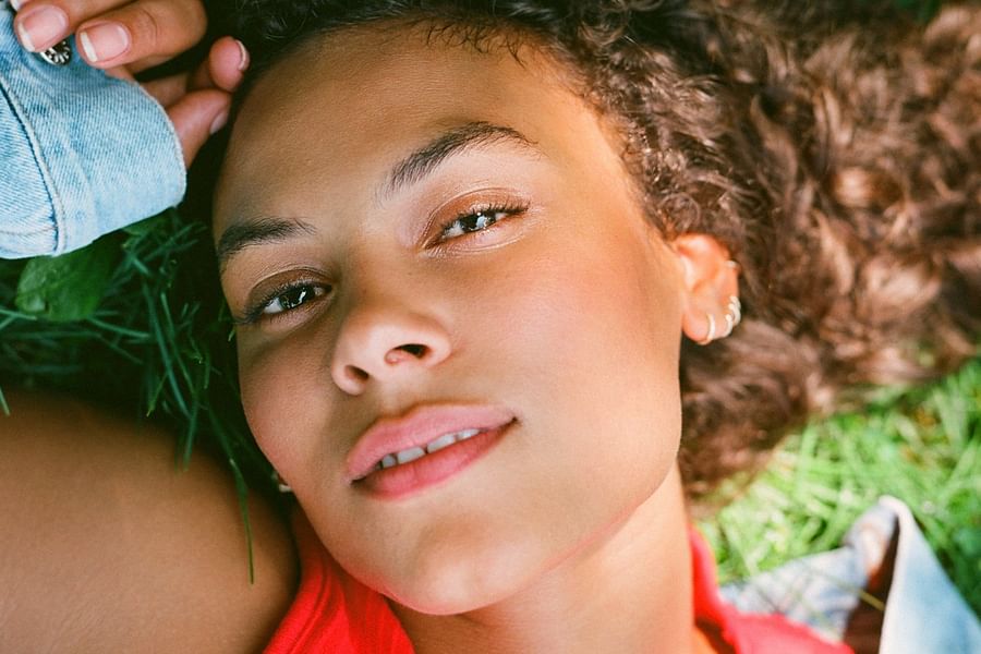 post-laser treatment sun sensitivity