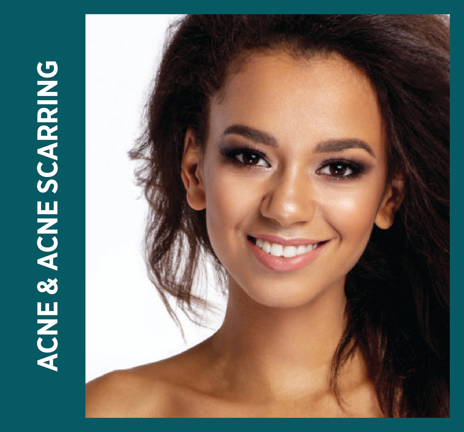 precision laser acne treatment