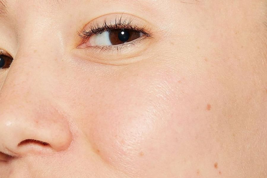 acne patch barrier protection