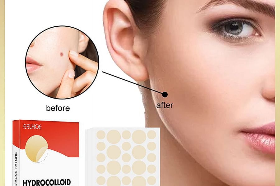 hydrocolloid patch absorbing pus