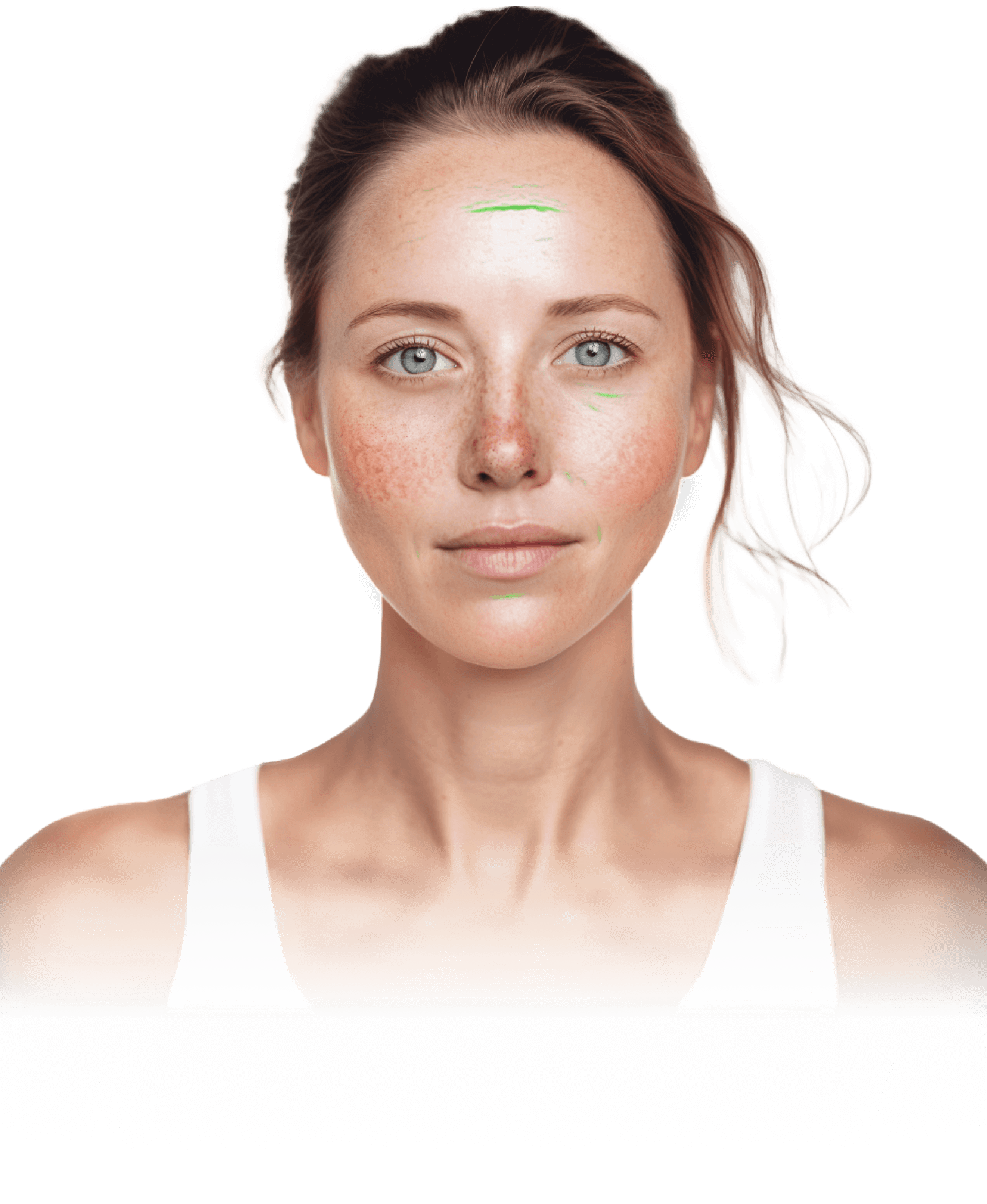 acne analysis smartphone app