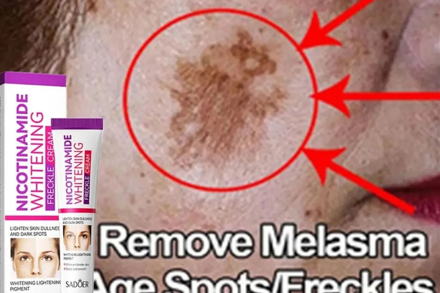 nicotinamide acne treatment