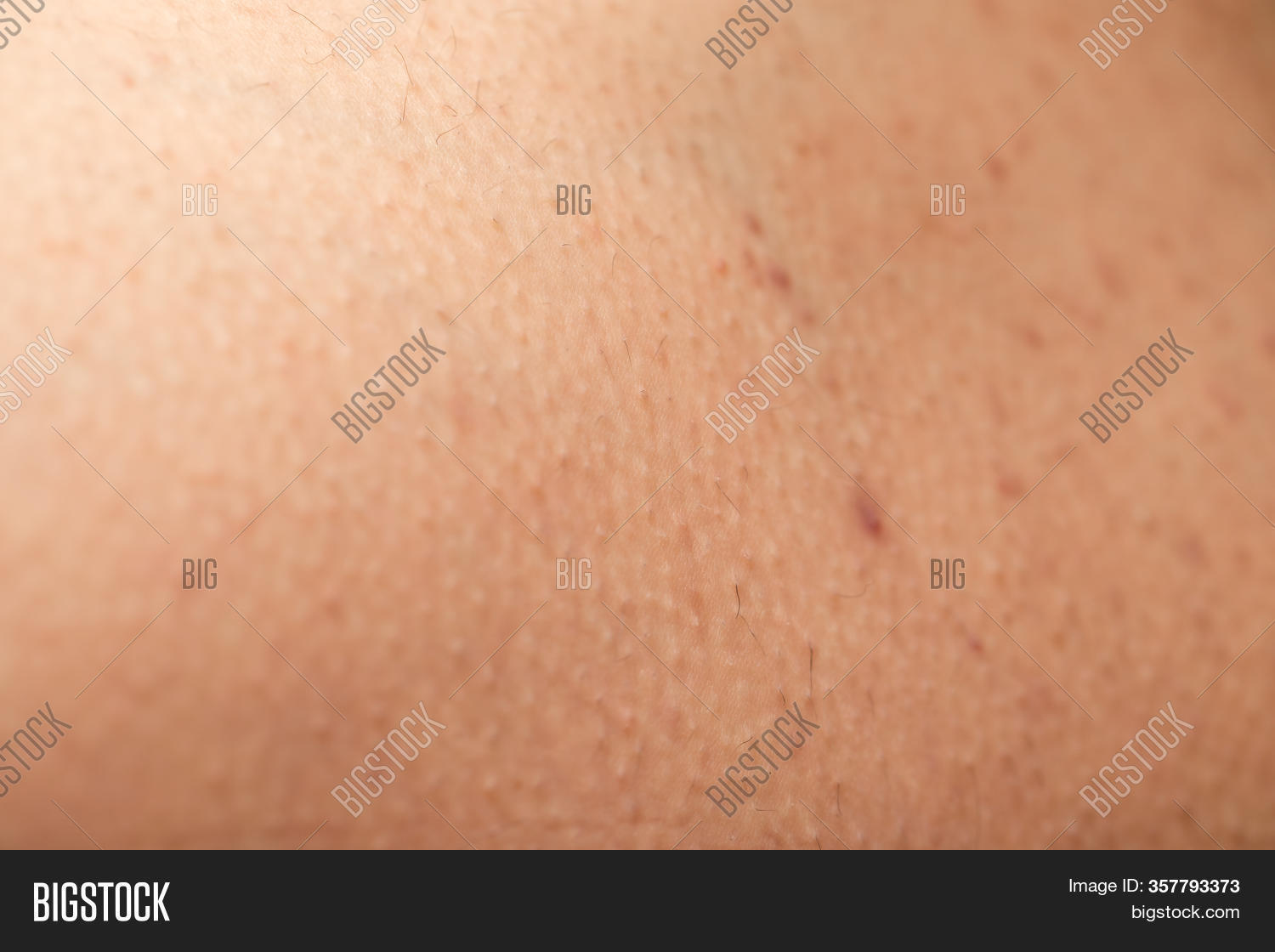 hormonal changes and skin image