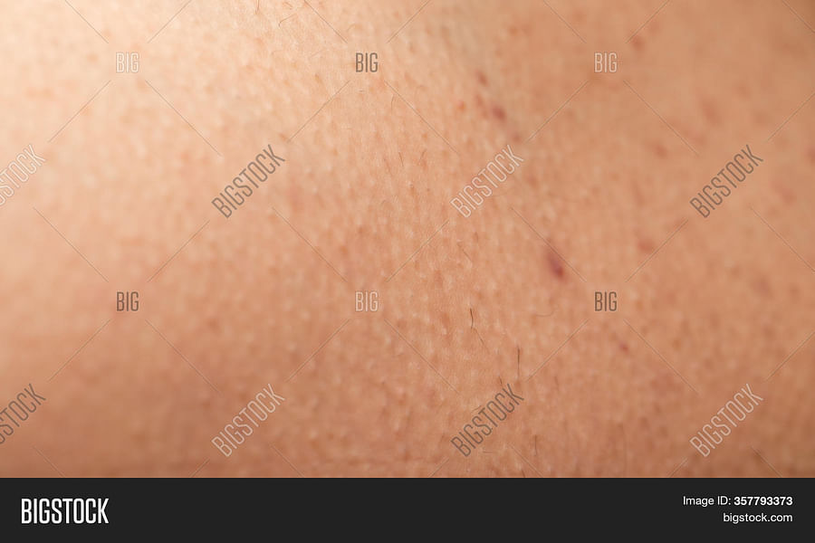 hormonal changes and skin image