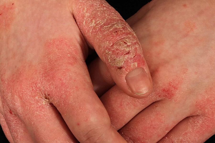 skin irritation causes image