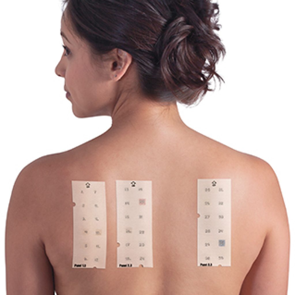 skin patch test
