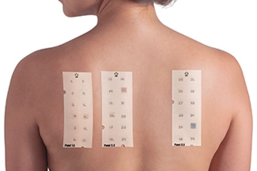 skin patch test