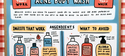 Acne Treatments
