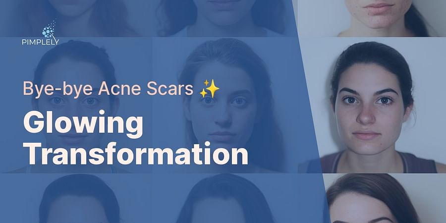 Glowing Transformation - Bye-bye Acne Scars ✨