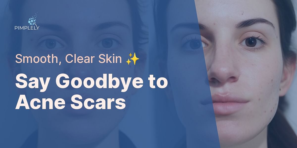 The Comprehensive Guide How To Treat And Hide Acne Scars Before And After